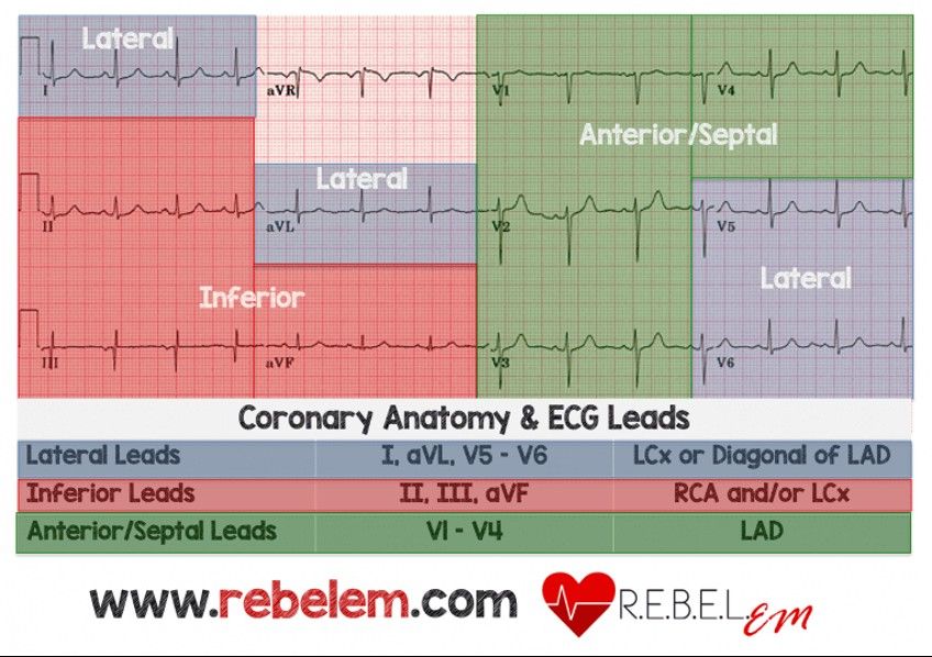 Lead groups mapped to coronary arteries — the slide's summary table.