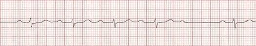 Practice: how would you interpret these findings, and what would be part of your assessment of this patient?