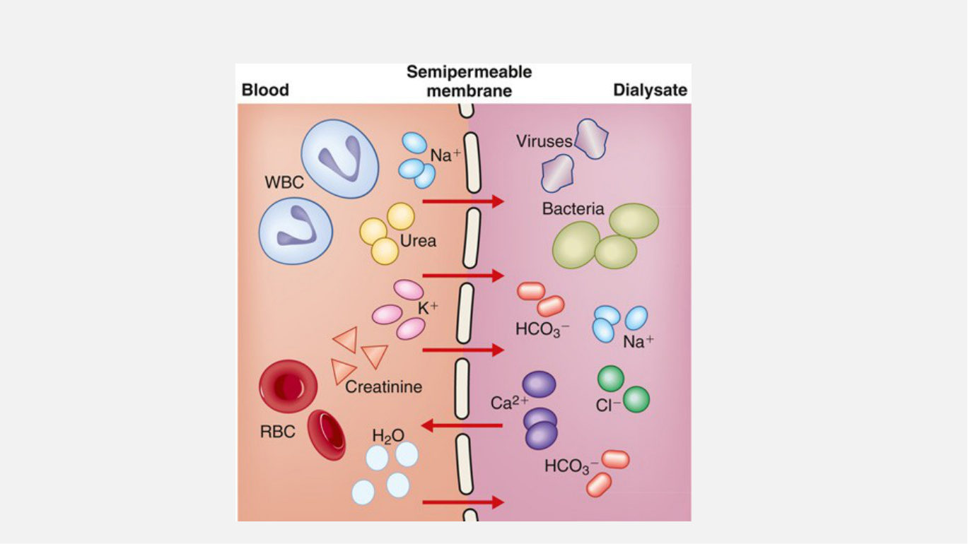 The three-compartment picture she talked over: blood on one side, the semipermeable membrane in the middle, dialysate on the other. Every row of the table above is one arrow across that middle line - what differs between HD and PD is not the membrane's job but what supplies the gradient, glucose or pressure.