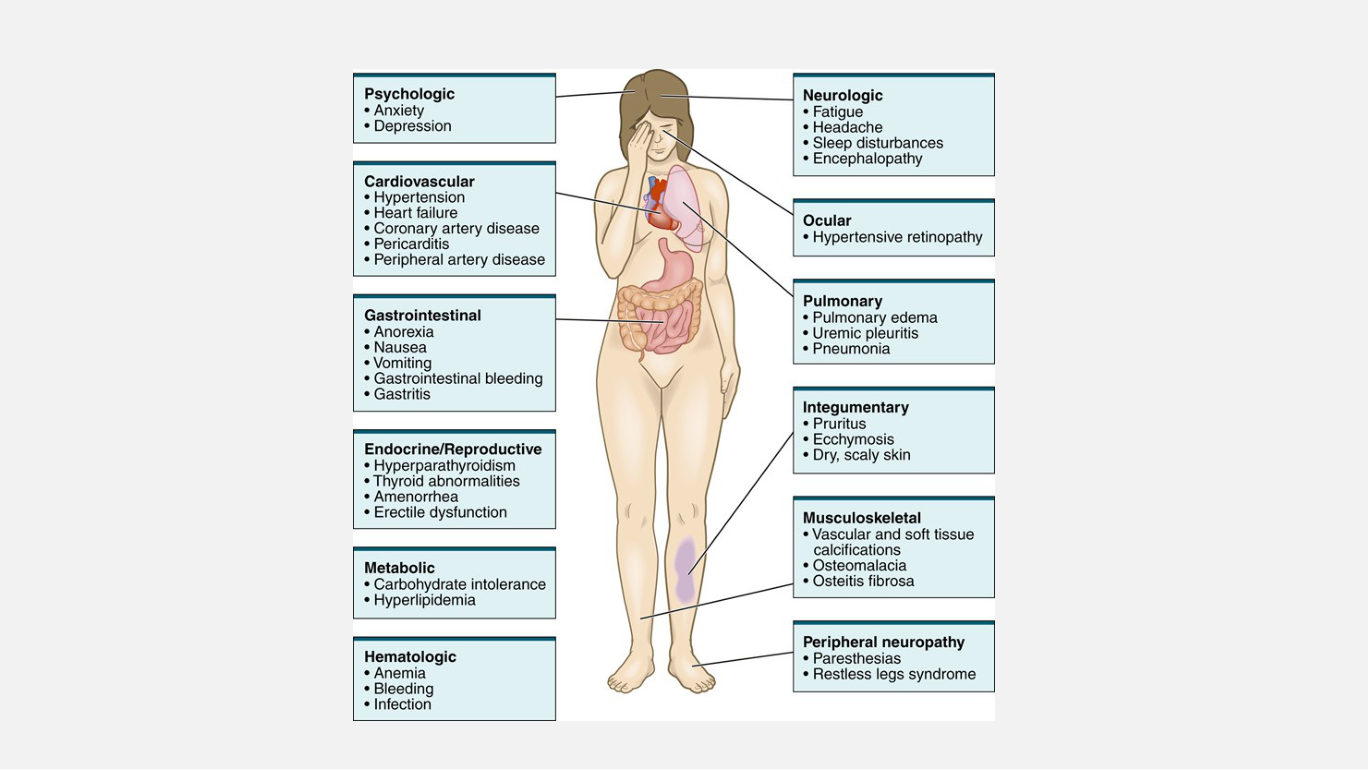 The whole-body view of CKD, reproduced in her deck from the textbook. Use it as the review sheet for sections 2.11 to 2.13 - each labelled system is one of the slides she taught, and reading it top to bottom is the fastest way to check whether you can supply the mechanism behind every heading.