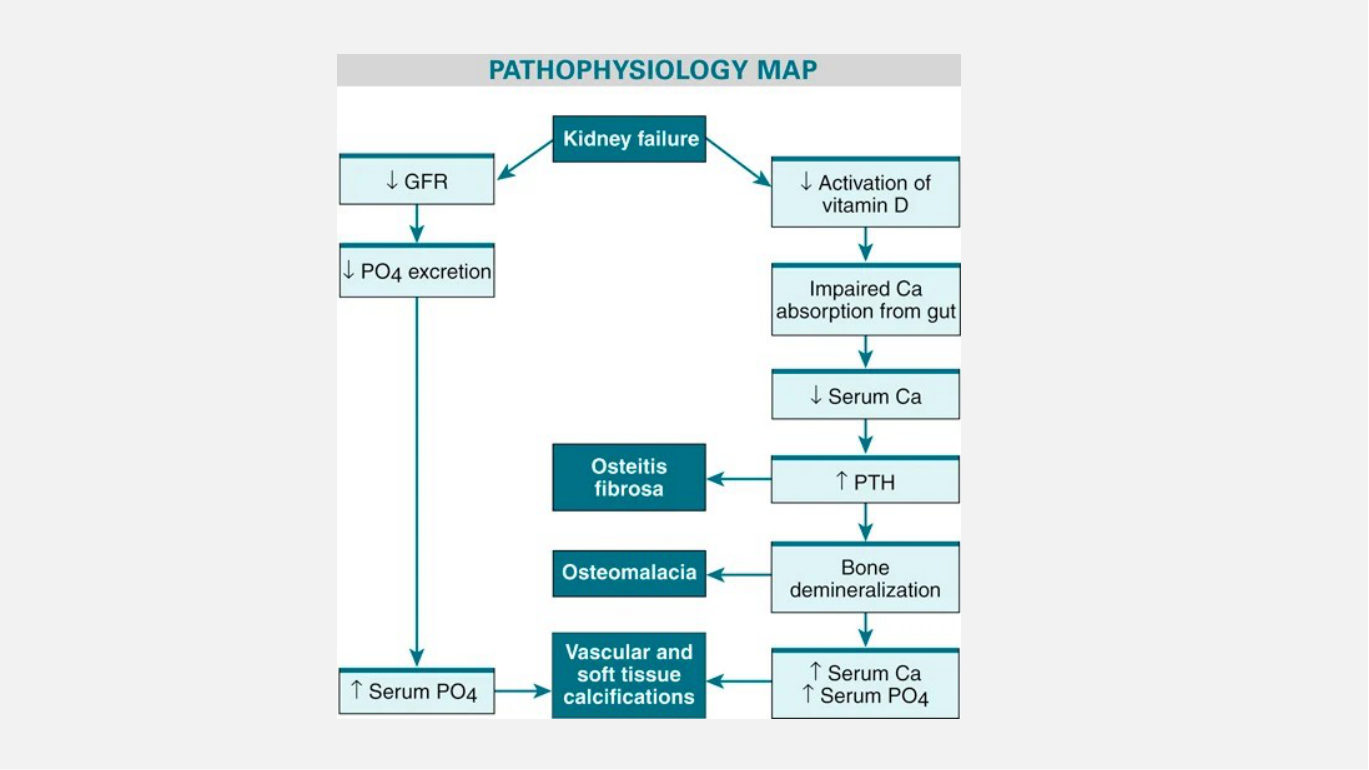 Her pathophysiology map of CKD mineral and bone disease, the wordless version of the chain above. Follow it from reduced vitamin D activation; the value of the map is that it shows the bone and the blood vessels as two outputs of the same arrow, which is why a bone problem in CKD is also a cardiovascular problem.