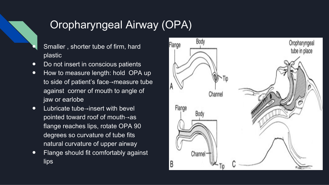 Her oropharyngeal airway slide, with the measurement and the 90-degree rotation on insertion. The rotation is the step most often asked about.
