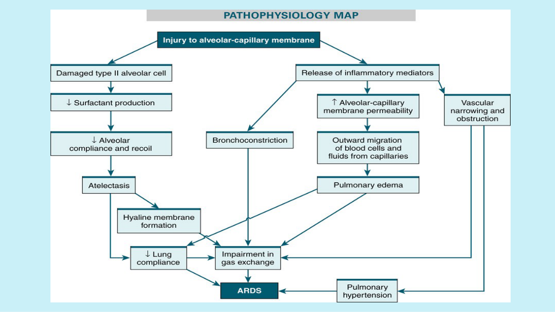 Her ARDS pathophysiology map. Follow the left branch: injury to the alveolar-capillary membrane → damaged alveolar cells → less surfactant → decreased compliance and recoil → atelectasis → hyaline membrane → impaired gas exchange → ARDS. The right branch is the inflammatory mediators: bronchoconstriction, vascular narrowing, pulmonary hypertension, and increased permeability leading to pulmonary edema.